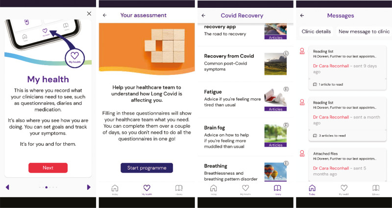 Implementation of Hospital-Initiated Complex Interventions for Adult People with Multiple Long-Term Conditions