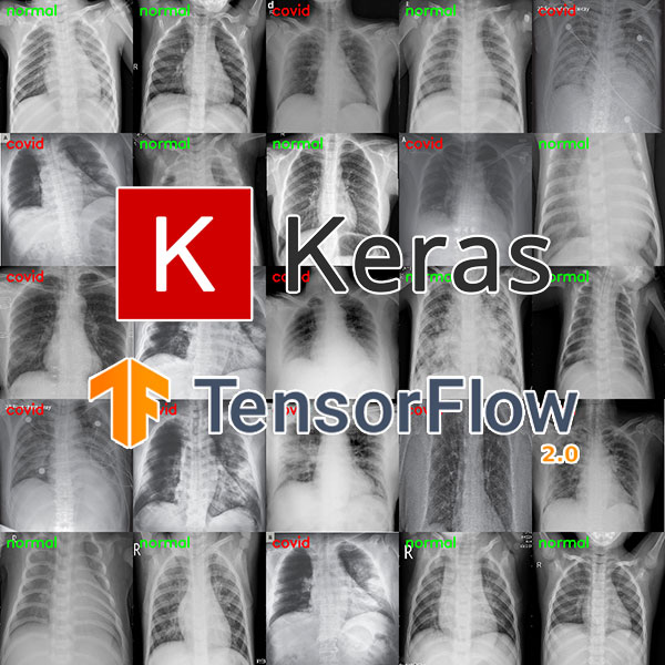 Detecting COVID19 in X-ray images with Keras, TensorFlow, and Deep Learning -