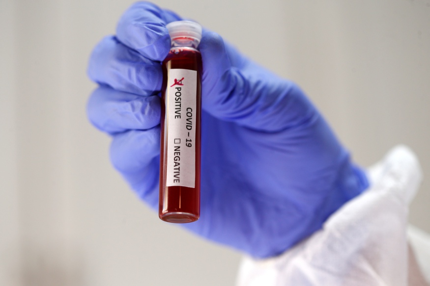Bosch Develops COVID-19 Test Tool to Detect Coronavirus in Under 3 Hours