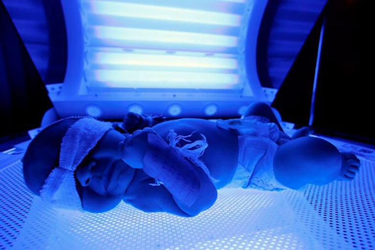 5 Advances in Medical Technology for Neonatal Nurses