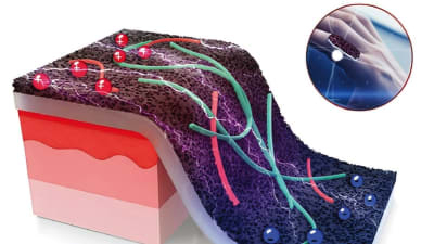 New Smart Sensor Takes the Pain Out of Wound Monitoring