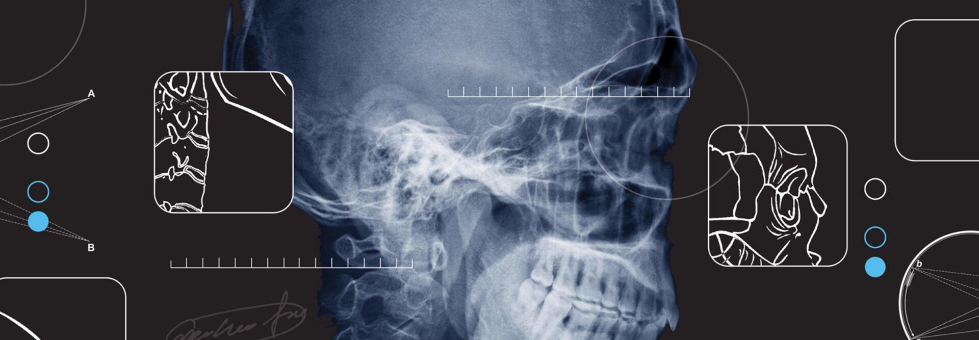 How Can AI Help Transform Radiology?