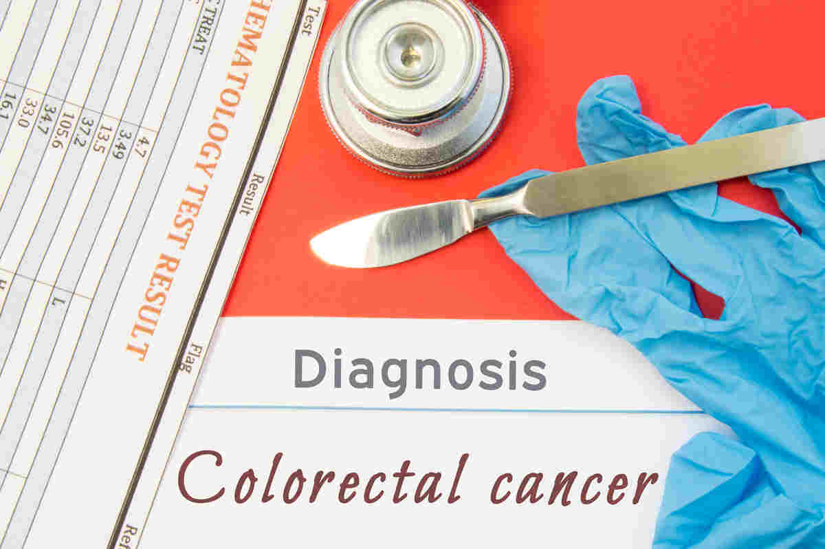 These Alternative Screening Methods Can Close the Colorectal Cancer Screening Gap