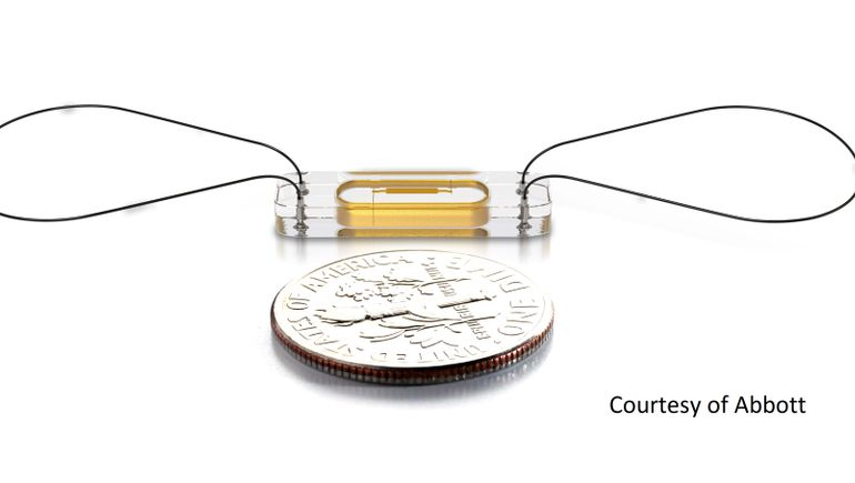 Abbott’s remote heart failure monitoring system reduces hospitalizations in clinical trial