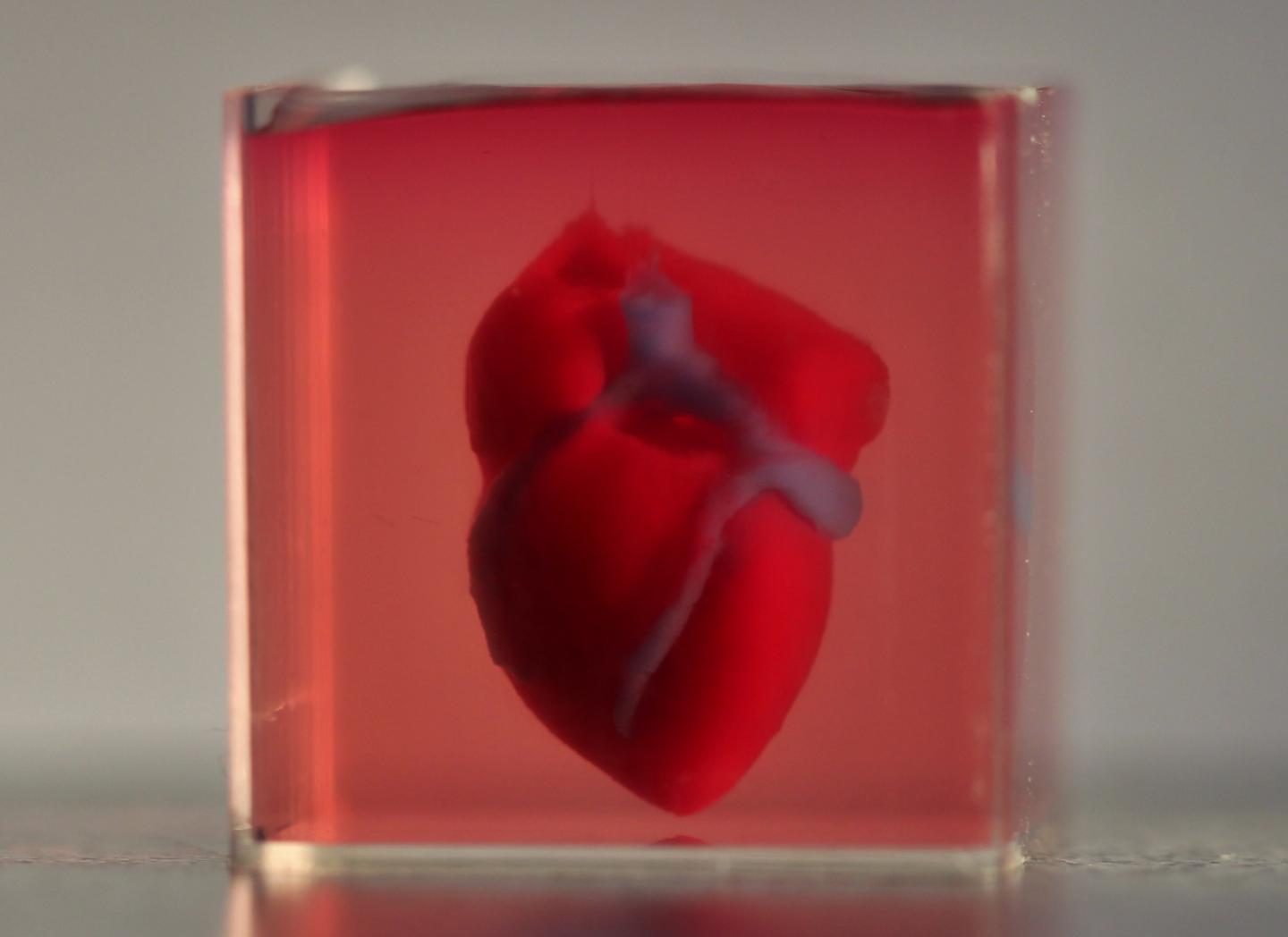 First 3D Engineered Vascularized Human Heart Is Bioprinted