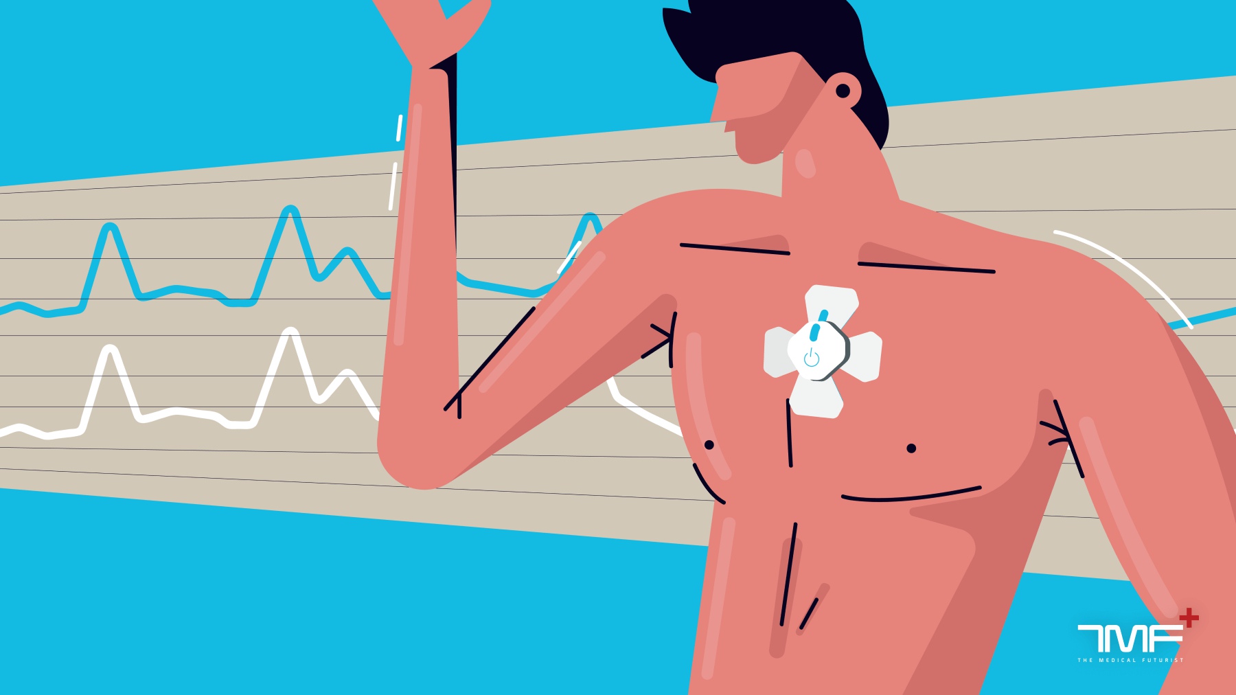 A 24-Hour Skin Patch That Monitors Blood Pressure: The BioBeat Review