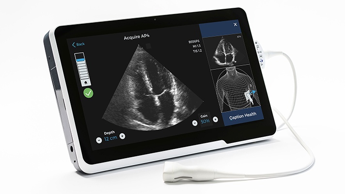AI-assisted cardiac ultrasound guidance software receives De Novo clearance