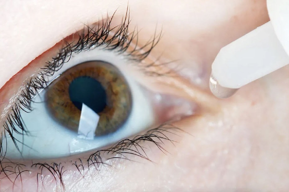 Breakthrough Eye Implant Marks a New Era in Glaucoma Surgery