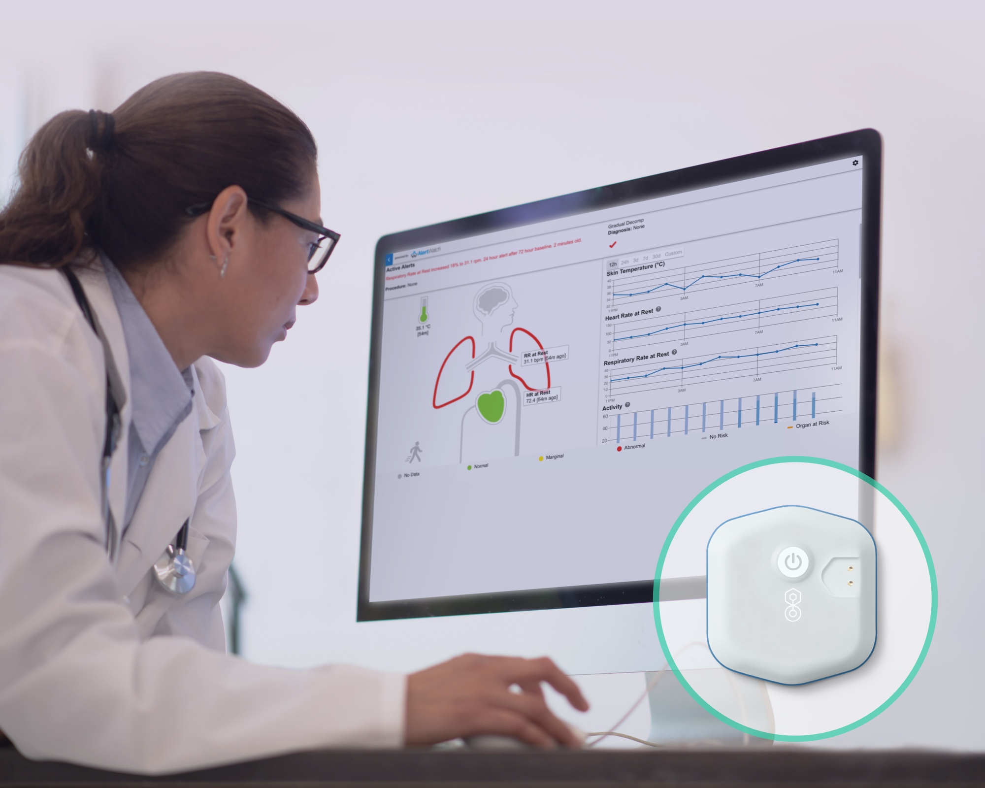 BioIntelliSense Acquires Patient Monitoring Company AlertWatch