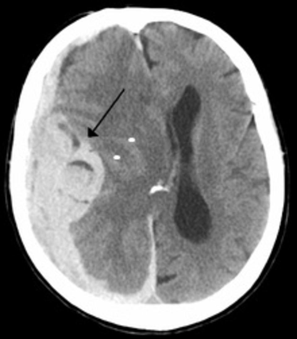 At RSNA19, Evidence Everywhere of the Application of AI to Radiological Practice