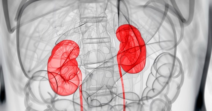 $10M Artificial Kidney Prize Now Live via HHS, American Society of Nephrology