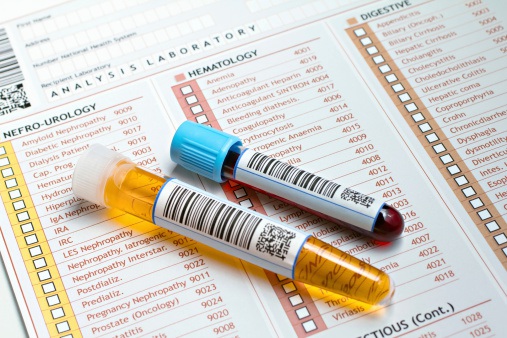 Coronavirus: Antibody testing, development of treatments & vaccines underway