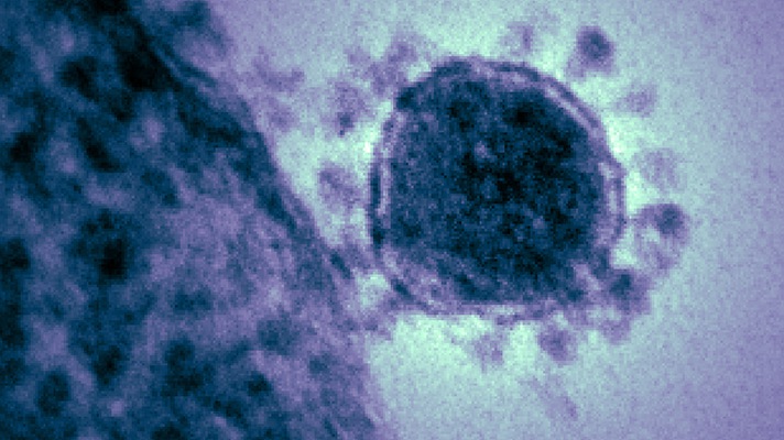 Epic pushes out software update to help spot coronavirus