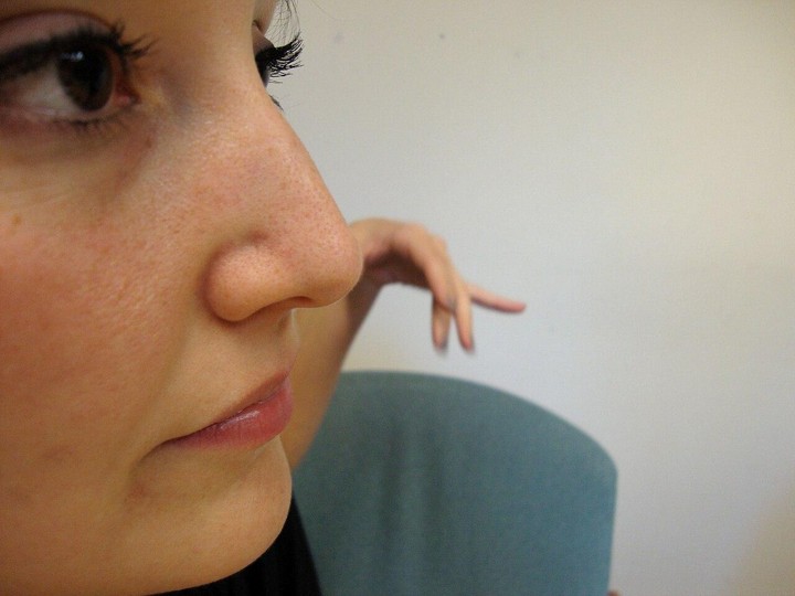 Is a Non-Surgical Nose Job Safe? Understanding Liquid Rhinoplasty Risks and How to Reduce Them