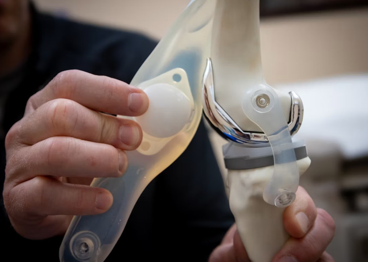 What to Expect the First Week After Arthroscopic Knee Surgery