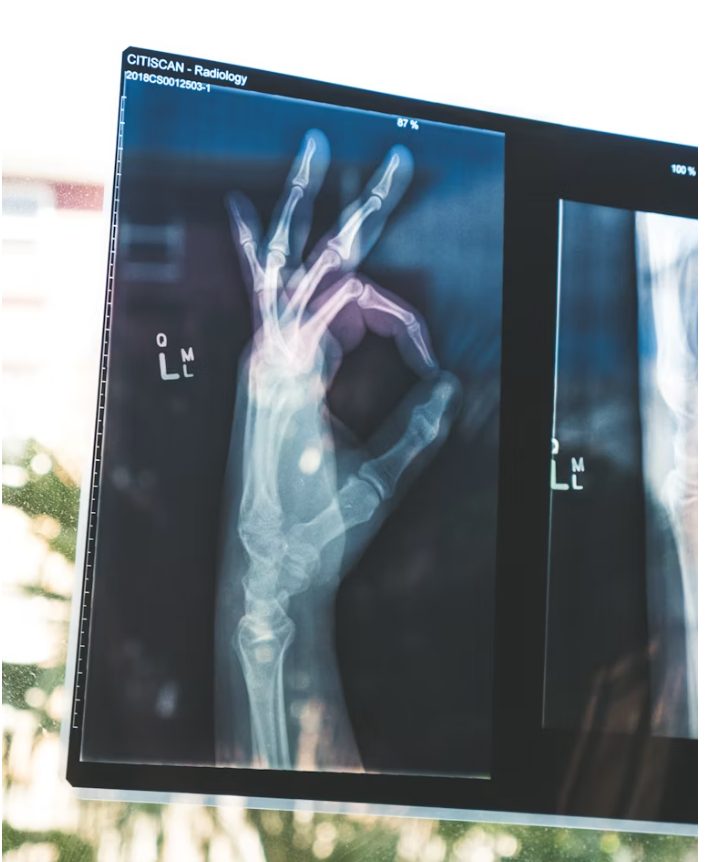 How Do You Know If Hip Replacement Is the Right Next Step?