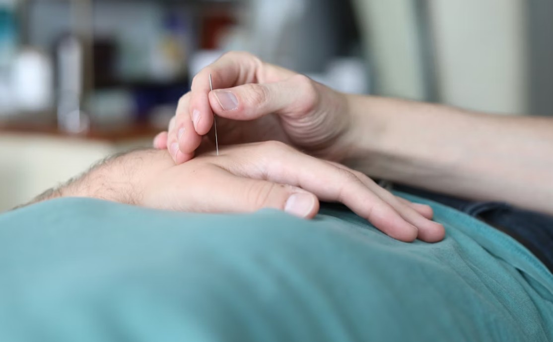 The Growing Need for Acupuncturists in Modern U.S. Healthcare