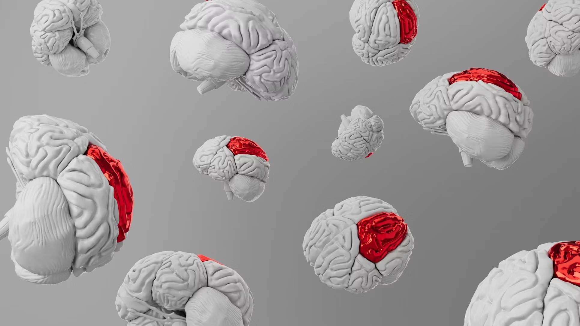 Why Pharma Sponsors Are Choosing Imaging-First CROs for Alzheimer’s and Parkinson’s Trials