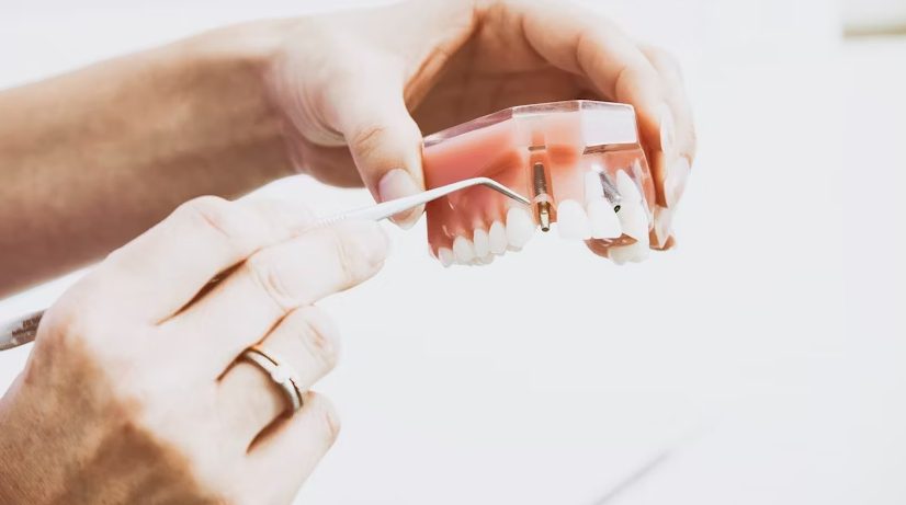 Root Canal Treatment with Modern Technology: Why It’s Faster and Safer