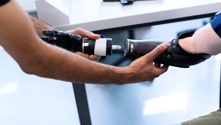 The Power of Titanium: Osseointegration Elevates Prosthetic Solutions for Amputees