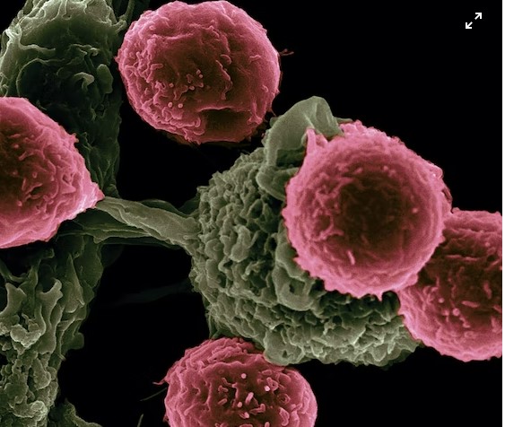 Cancer Care in 2026: The Rise of “Less Damage, More Precision” Treatment