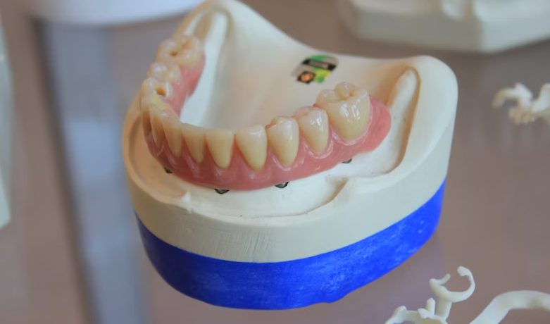 Can a Confident Smile Change How You Feel?
