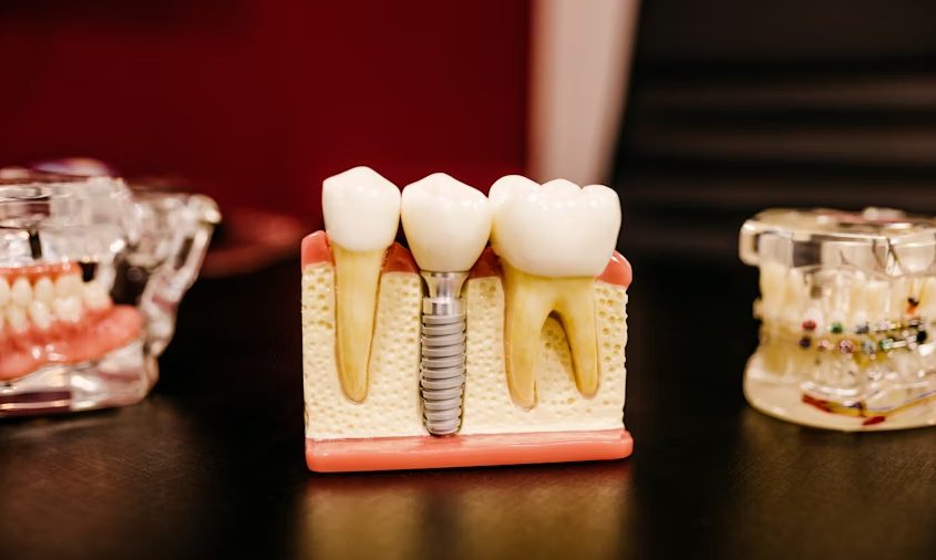 From Routine Checkups to Cosmetic Enhancements: Navigating St. George Dental Services