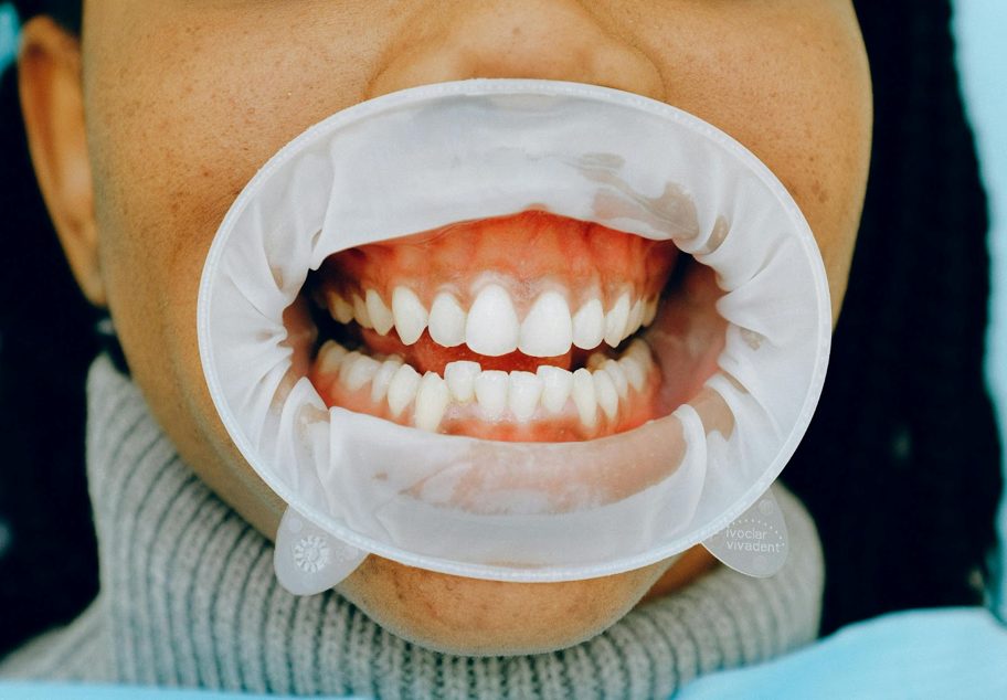 What a Periodontist in Allen Can Do for Advanced Gum Disease Treatment