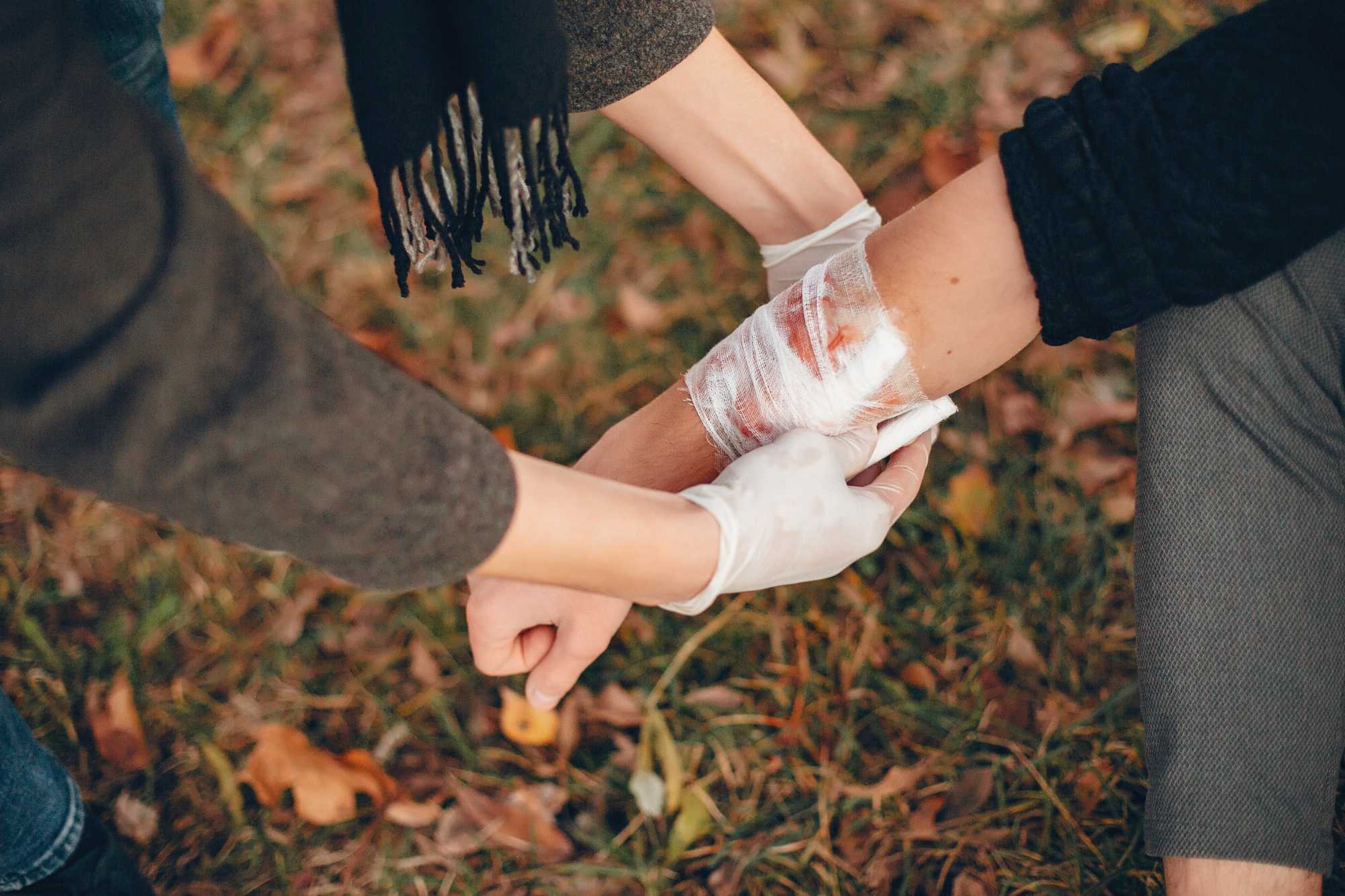 How Severe Burns Can Affect Your Daily Life
