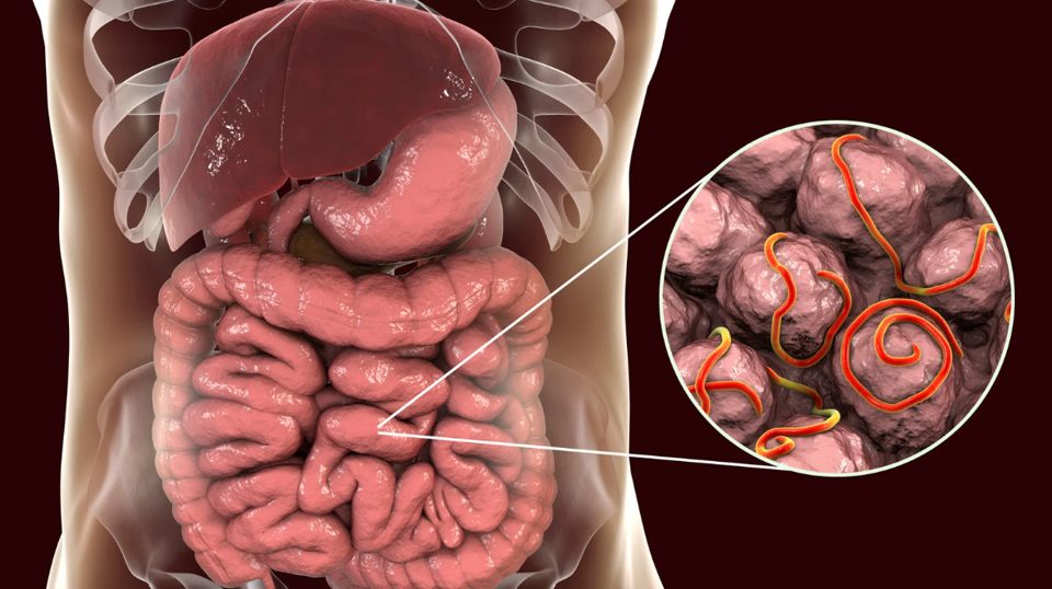 Intestinal Parasite Symptoms: Why Testing Matters Before Treatment
