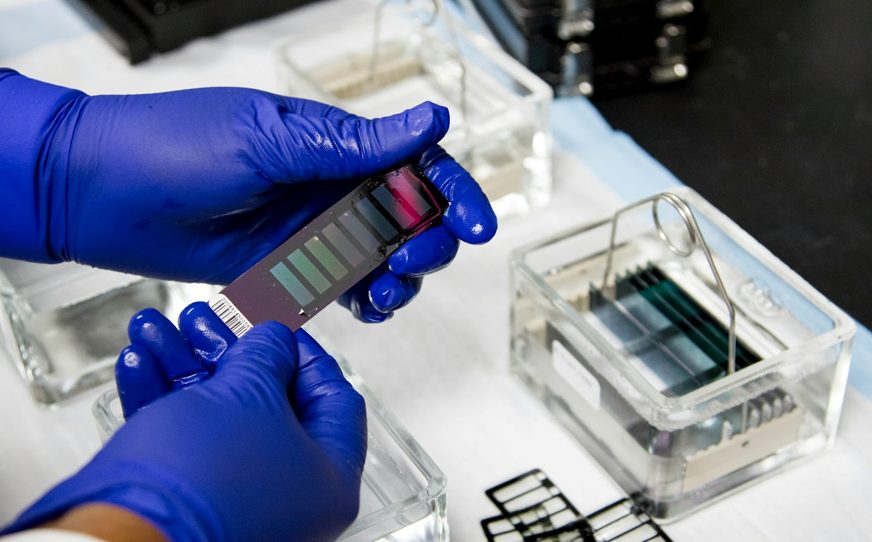 Genetic Testing for Heart Disease: Should You Get Screened?