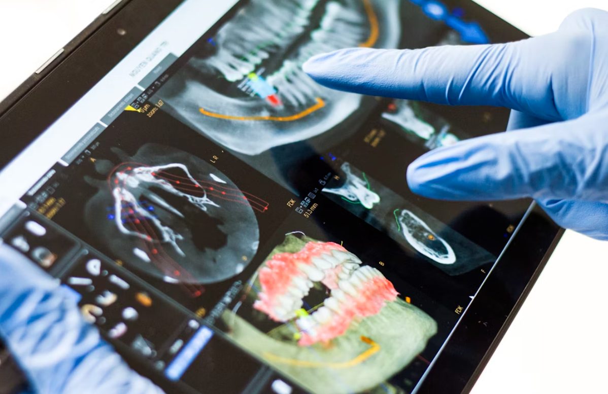 Why Do Growing Practices Need Professional Dental Billing Partners?