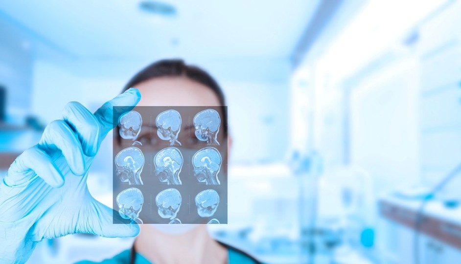 5 Questions to Ask Before Hiring a Traumatic Brain Injury Lawyer