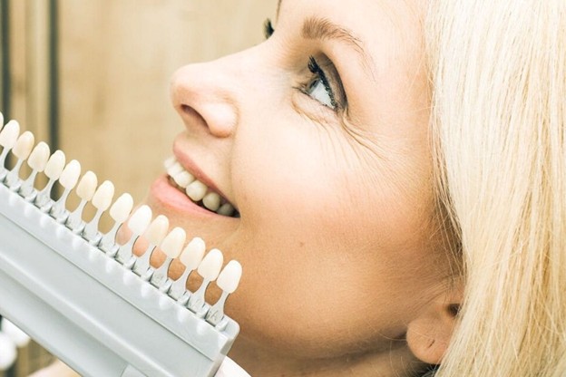 The Process of Getting Porcelain Veneers in Jacksonville