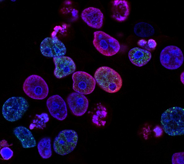 Cancer in 2026: The Era of “Invisible Recovery” and Body-Preserving Treatment