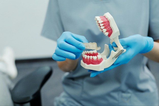 What to Expect With Dental Implants in Atlanta