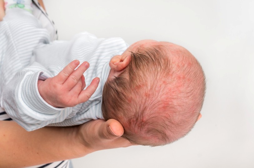 The Lifetime Costs of a Birth Injury That Many Families Do Not Expect