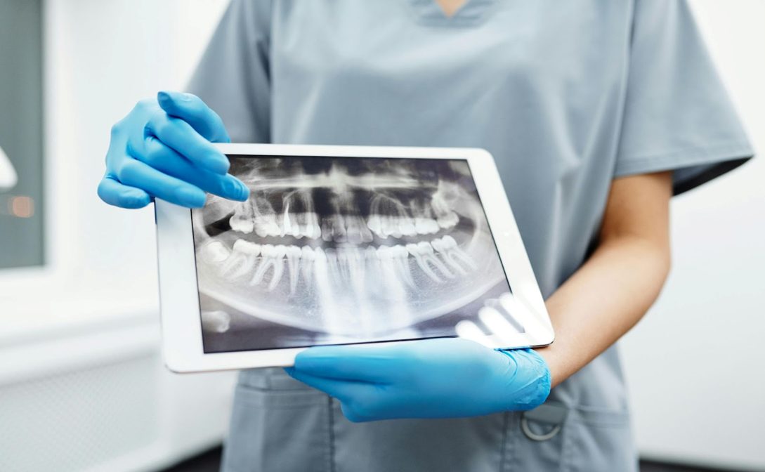 Understanding Root Canal Treatments in Jersey City, NJ