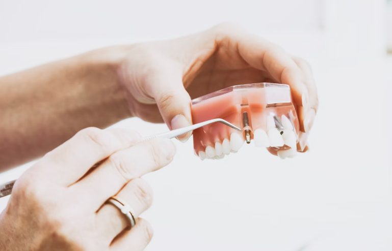 Best Dentists in Forest Hills for Implants and Cosmetic Dentistry