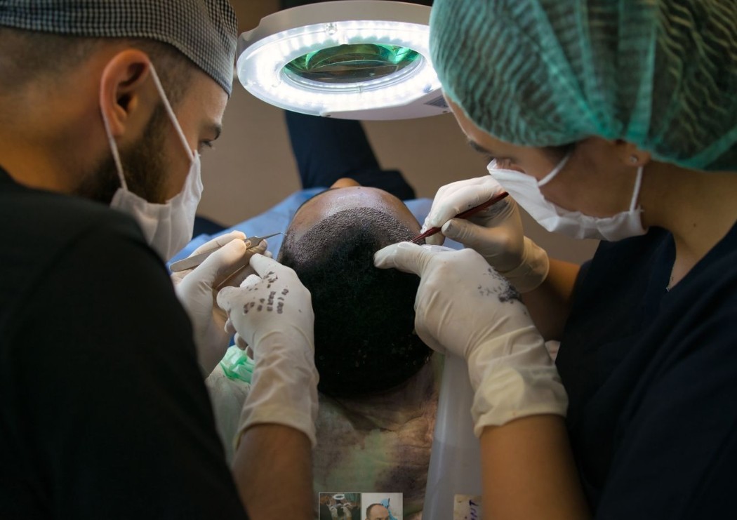 Donor Hair: Supply, Regrowth, and Transplant Planning