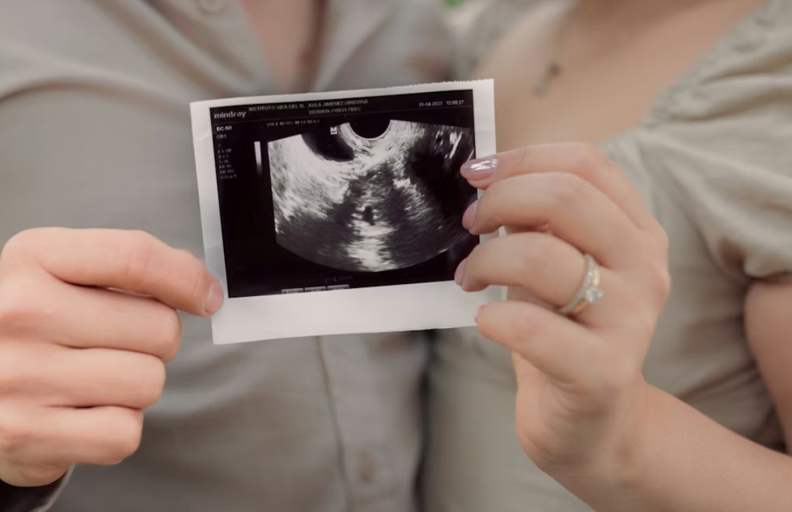 When to Book Your First Pregnancy Ultrasound Scan