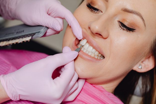 Are Dental Veneers Right for You? What to Consider