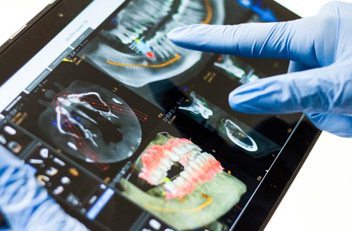 What 3D Imaging Can Reveal Before Dental Implant Surgery Begins