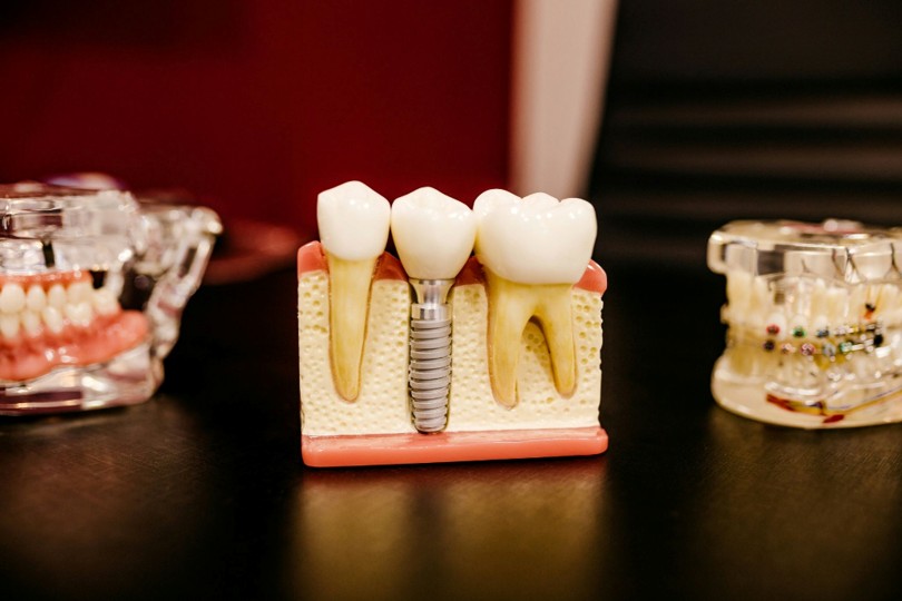 How Digital Platforms Are Simplifying the Search for Dental Plans