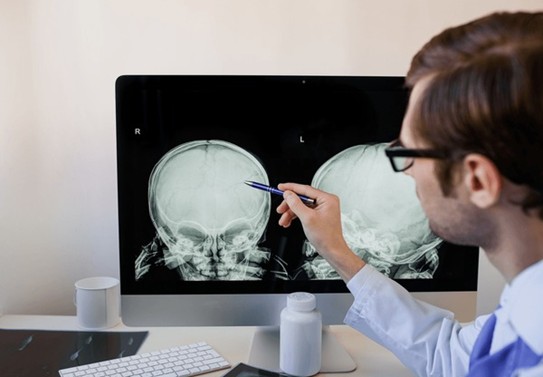 5 Warning Signs of a Skull Fracture That May Turn Fatal