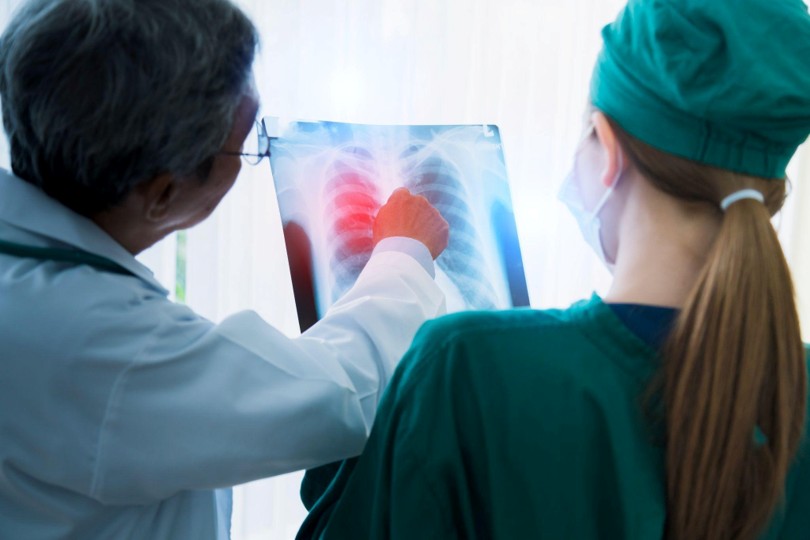 Lung Cancer Biomarker Testing: What to Ask Before Treatment Starts