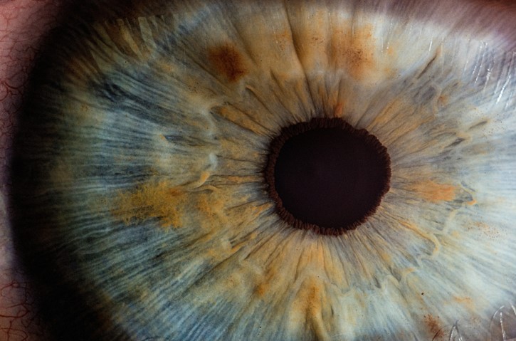 Unlocking the Secrets of Sight: How New Technologies Are Transforming Eye Care