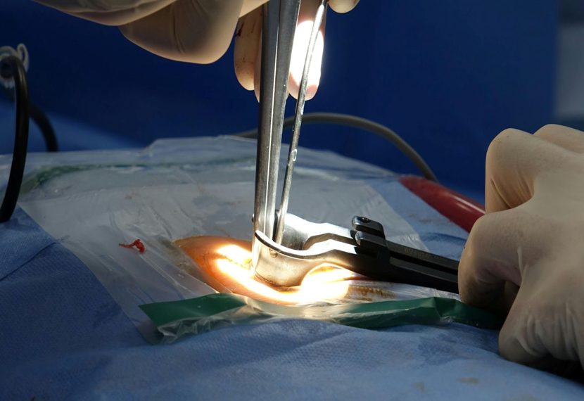 How Tampa Specialists Diagnose and Treat Herniated Discs Effectively