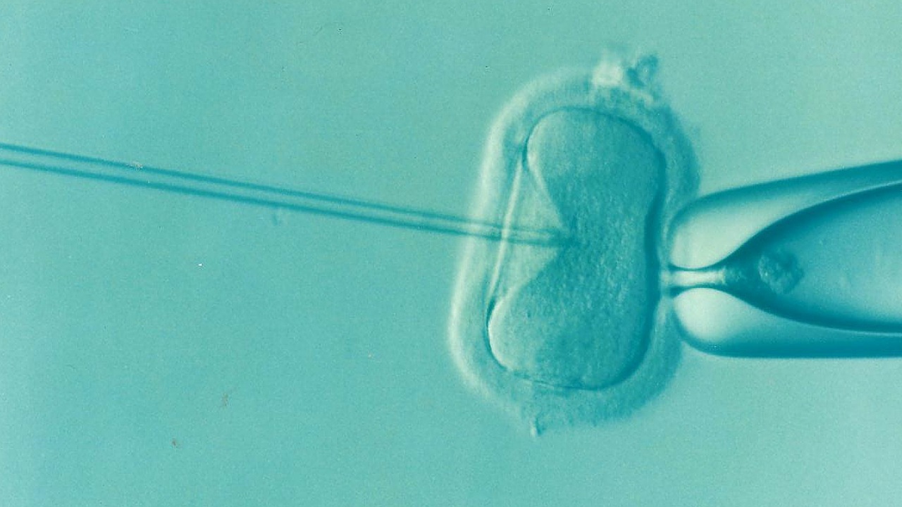 Building Confidence Through Customized IVF and Informed Decision-Making