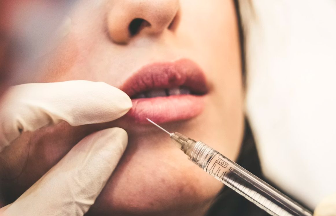 Thinking About Lip Injections? Here’s How to Know If They’re Right for You